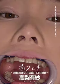 歯フェチ ～超超超激レアの歯?口内観察～ 高梨有纱 ad-534